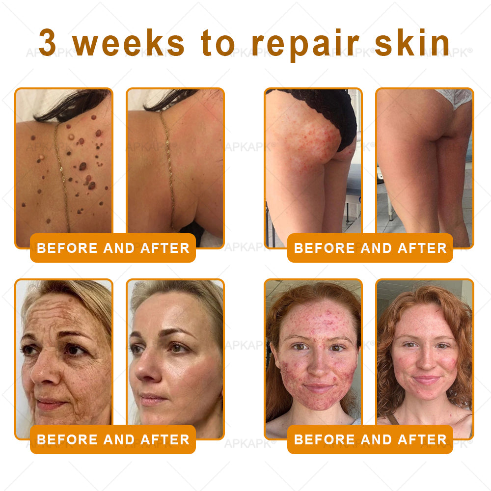 š Wait! Donāt Miss This Exclusive Upgrade ā As a valued APKAPKĀ® customer, youāve unlocked an extra 30% OFF today only! Add another to your order now and save more ā once you leave this page, this deal is gone forever!