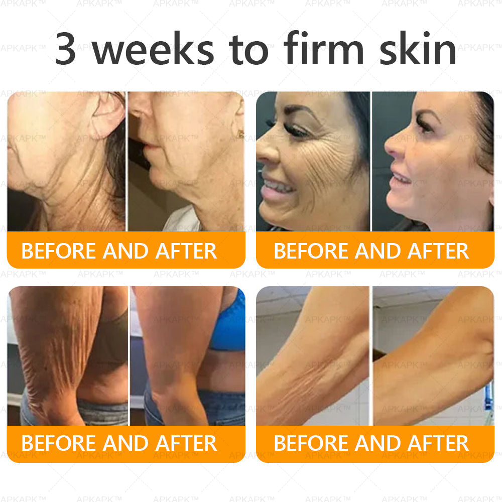 š Wait! Donāt Miss This Exclusive Upgrade ā As a valued APKAPKĀ® customer, youāve unlocked an extra 30% OFF today only! Add another to your order now and save more ā once you leave this page, this deal is gone forever!