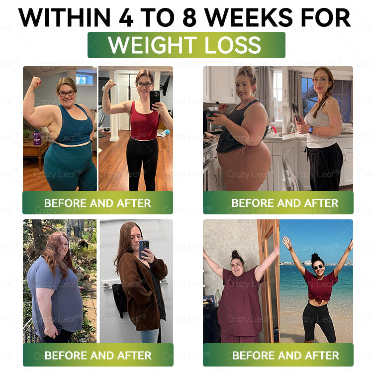 Clinically Proven|Official Store | CrazyLeaf® SMGT-GLP-1 Nano Microneedle Patch with Collagen & Matrixyl 3000 丨Targets Obesity, Loose Skin, High Blood Pressure, Diabetes, Fatty Liver, Joint Pain, Brain Fog, Low Energy, Body Aches, and More