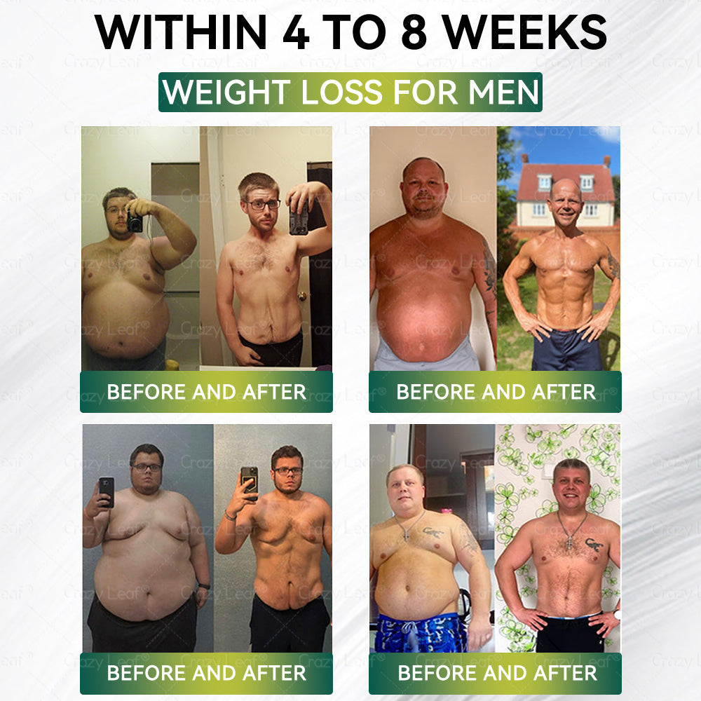 Clinically Proven|Official Store | CrazyLeaf® SMGT-GLP-1 Nano Microneedle Patch with Collagen & Matrixyl 3000 丨Targets Obesity, Loose Skin, High Blood Pressure, Diabetes, Fatty Liver, Joint Pain, Brain Fog, Low Energy, Body Aches, and More