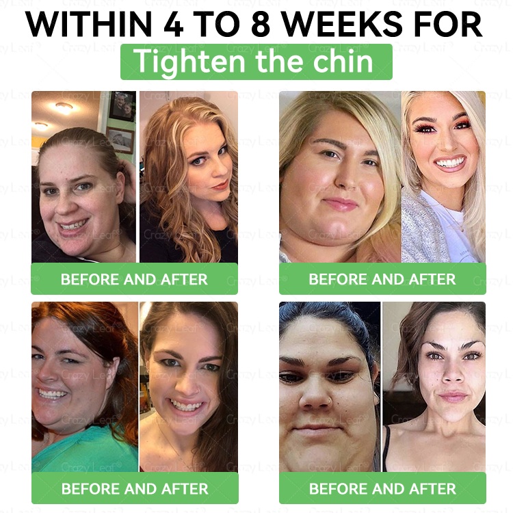 🎉 𝐂𝒓𝓪𝙯𝙮𝐋𝑒𝑎𝐟® has a surprise upgrade! You've unlocked an amazing offer, but now you can get 50% OFF your next purchase — for the next 2 minutes only! ⏳ Hurry, don't miss out on this exclusive deal for 𝐂𝒓𝓪𝙯𝙮𝐋𝑒𝑎𝐟® SMGT-GLP-1!