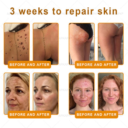 𝐌𝐚𝐝𝐞 𝐚𝐧𝐝 𝐒𝐡𝐢𝐩𝐩𝐞𝐝 𝐟𝐫𝐨𝐦 𝐂𝐀✨𝖠𝖯𝖪𝖠𝖯𝖪® 𝖡𝖾𝖾 𝗏𝖾𝗇𝗈𝗆 𝖲𝗄𝗂𝗇 𝖱𝖾𝗌𝗍𝗈𝗋𝖺𝗍𝗂𝗈𝗇 𝖢𝗋𝖾𝖺𝗆