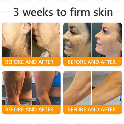 𝐌𝐚𝐝𝐞 𝐚𝐧𝐝 𝐒𝐡𝐢𝐩𝐩𝐞𝐝 𝐟𝐫𝐨𝐦 𝐂𝐀✨𝖠𝖯𝖪𝖠𝖯𝖪® 𝖡𝖾𝖾 𝗏𝖾𝗇𝗈𝗆 𝖲𝗄𝗂𝗇 𝖱𝖾𝗌𝗍𝗈𝗋𝖺𝗍𝗂𝗈𝗇 𝖢𝗋𝖾𝖺𝗆