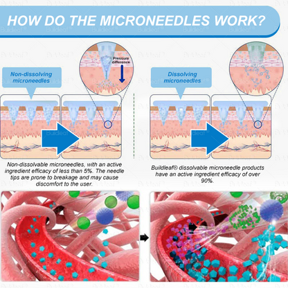 Clinically Proven|Official Store | Buildleaf® Tirzepatide Nano Microneedle Patch with Collagen & Matrixyl 3000 丨Targets Obesity, Loose Skin, High Blood Pressure, Diabetes, Fatty Liver, Joint Pain, Brain Fog, Low Energy, Body Aches, and More