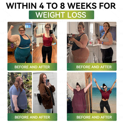 Clinically Proven|Official Store | CrazyLeaf® SMGT-GLP-1 Nano Microneedle Patch with Collagen & Matrixyl 3000 丨Targets Obesity, Loose Skin, High Blood Pressure, Diabetes, Fatty Liver, Joint Pain, Brain Fog, Low Energy, Body Aches, and More