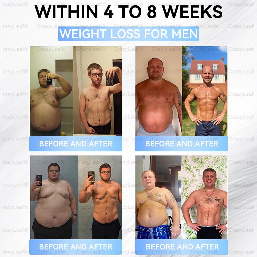 𝐂𝐥𝐢𝐧𝐢𝐜𝐚𝐥𝐥𝐲 𝐏𝐫𝐨𝐯𝐞𝐧| 𝐎𝐟𝐟𝐢𝐜𝐢𝐚𝐥 𝐒𝐭𝐨𝐫𝐞 | 𝐁𝐮𝐢𝐥𝐝𝐿𝑒𝒂𝒇® 𝑇𝑖𝑟𝑧𝑒𝑝𝑎𝑡𝑖𝐝𝐞 𝗦𝗹𝗶𝗺𝗺𝗶𝗻𝗴 & 𝗛𝗲𝗮𝗹𝐭𝐡 𝐍𝐚𝐧𝐨 𝐌𝐢𝐜𝐫𝐨𝐧𝐞𝐞𝐝𝐥𝐞 𝐏𝐚𝐭𝐜𝐡 |𝐓𝐚𝐫𝐠𝐞𝐭𝐬 𝑜𝑏𝑒𝑠𝑖𝘁𝘆, 𝗟𝗼𝗼𝘀𝗲 𝗦𝗸𝗶𝗻, 𝗛𝗶𝗴𝗵 𝗕𝗹𝗼𝗼𝗱 𝗣𝗿𝗲𝘀𝘀𝘂𝗿𝗲, 𝗗𝗶𝗮𝗯𝗲𝘁𝗲𝘀, 𝗙𝗮𝘁𝘁𝘆 𝗟𝗶𝘃𝗲𝗿, 𝗝𝗼𝗶𝗻𝘁 𝗣𝗮𝗶𝗻, 𝗕𝗿𝗮𝗶𝗻 𝗙𝗼𝗴, 𝗟𝗼𝘄 𝗘𝗻𝗲𝗿𝗴𝘆, 𝐁𝐨𝐝𝐲 𝐀𝐜𝐡𝐞𝐬, 𝐚𝐧𝐝 𝐌𝐨𝐫𝐞