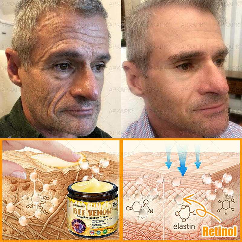 𝐌𝐚𝐝𝐞 𝐚𝐧𝐝 𝐒𝐡𝐢𝐩𝐩𝐞𝐝 𝐟𝐫𝐨𝐦 𝐂𝐀✨𝖠𝖯𝖪𝖠𝖯𝖪® 𝖡𝖾𝖾 𝗏𝖾𝗇𝗈𝗆 𝖲𝗄𝗂𝗇 𝖱𝖾𝗌𝗍𝗈𝗋𝖺𝗍𝗂𝗈𝗇 𝖢𝗋𝖾𝖺𝗆