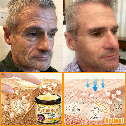 𝐌𝐚𝐝𝐞 𝐚𝐧𝐝 𝐒𝐡𝐢𝐩𝐩𝐞𝐝 𝐟𝐫𝐨𝐦 𝐂𝐀✨𝖠𝖯𝖪𝖠𝖯𝖪® 𝖡𝖾𝖾 𝗏𝖾𝗇𝗈𝗆 𝖲𝗄𝗂𝗇 𝖱𝖾𝗌𝗍𝗈𝗋𝖺𝗍𝗂𝗈𝗇 𝖢𝗋𝖾𝖺𝗆