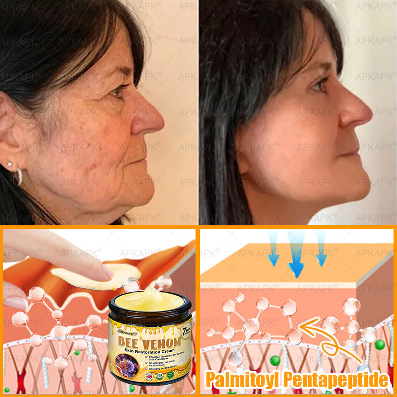 𝐌𝐚𝐝𝐞 𝐚𝐧𝐝 𝐒𝐡𝐢𝐩𝐩𝐞𝐝 𝐟𝐫𝐨𝐦 𝐂𝐀✨𝖠𝖯𝖪𝖠𝖯𝖪® 𝖡𝖾𝖾 𝗏𝖾𝗇𝗈𝗆 𝖲𝗄𝗂𝗇 𝖱𝖾𝗌𝗍𝗈𝗋𝖺𝗍𝗂𝗈𝗇 𝖢𝗋𝖾𝖺𝗆