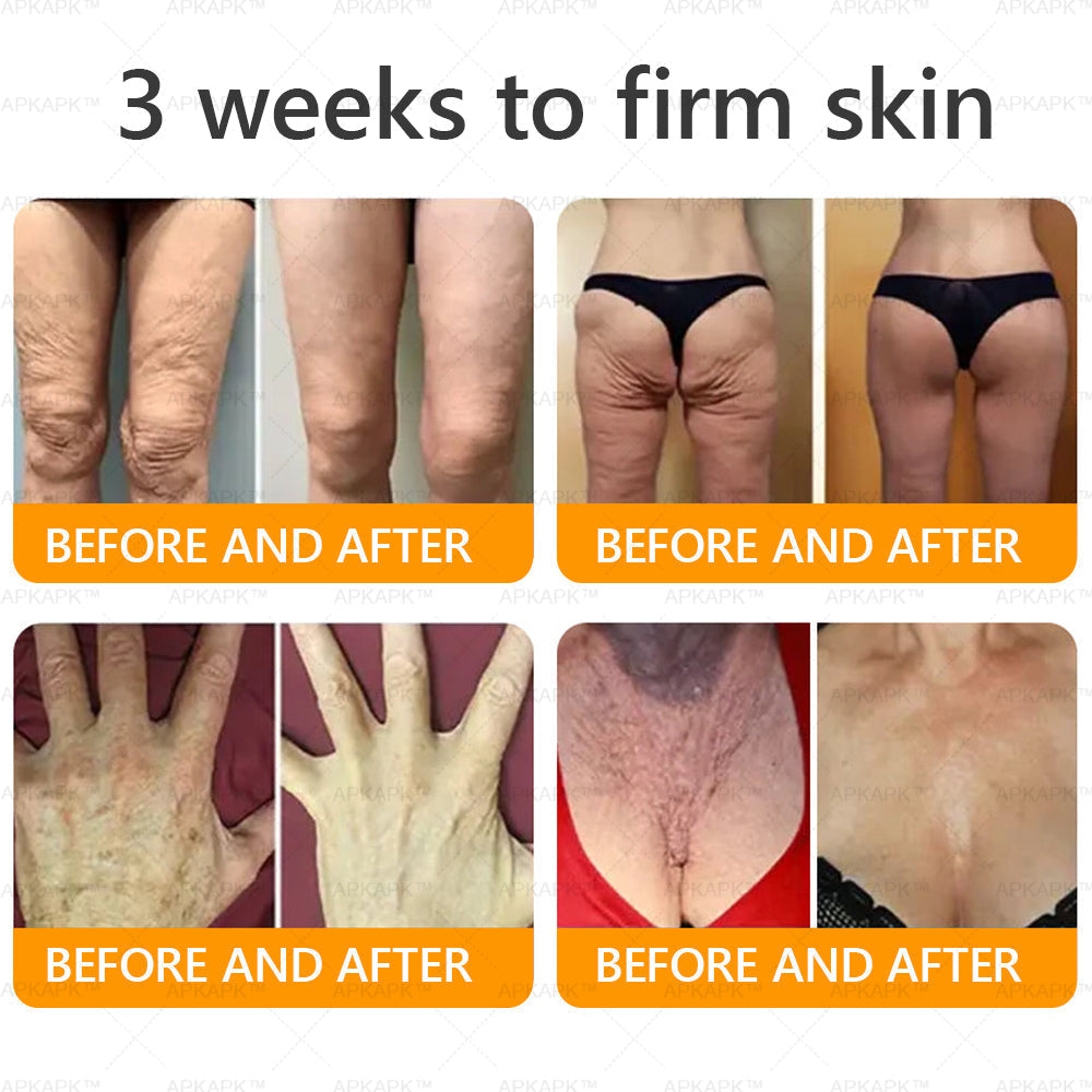 𝐌𝐚𝐝𝐞 𝐚𝐧𝐝 𝐒𝐡𝐢𝐩𝐩𝐞𝐝 𝐟𝐫𝐨𝐦 𝐂𝐀✨𝖠𝖯𝖪𝖠𝖯𝖪® 𝖡𝖾𝖾 𝗏𝖾𝗇𝗈𝗆 𝖲𝗄𝗂𝗇 𝖱𝖾𝗌𝗍𝗈𝗋𝖺𝗍𝗂𝗈𝗇 𝖢𝗋𝖾𝖺𝗆