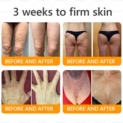 𝐌𝐚𝐝𝐞 𝐚𝐧𝐝 𝐒𝐡𝐢𝐩𝐩𝐞𝐝 𝐟𝐫𝐨𝐦 𝐂𝐀✨𝖠𝖯𝖪𝖠𝖯𝖪® 𝖡𝖾𝖾 𝗏𝖾𝗇𝗈𝗆 𝖲𝗄𝗂𝗇 𝖱𝖾𝗌𝗍𝗈𝗋𝖺𝗍𝗂𝗈𝗇 𝖢𝗋𝖾𝖺𝗆